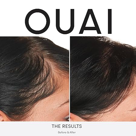 OUAI Scalp Serum – Balancing Hair Serum with Red Clover Extract, Siberian Ginseng & Peptides for Thicker, Fuller Hair – Paraben & Sulfate-Free, 2 Fl Oz